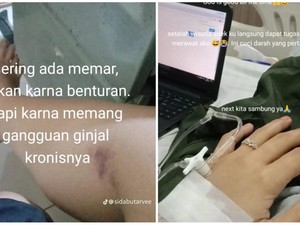Kronologi Wanita Medan Idap Gagal Ginjal, Sempat 2 Hari Cegukan Tak Berhenti
