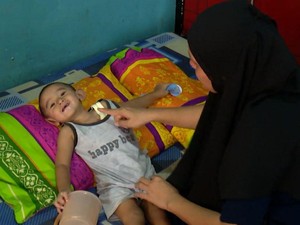 Kisah Pilu Balita Amar Didera Kelainan Jantung, Usus hingga Lambung