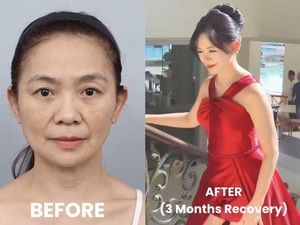 Dulu Viral Karena Awet Muda, Ini Penampilan Baru Puspa Dewi Setelah Oplas