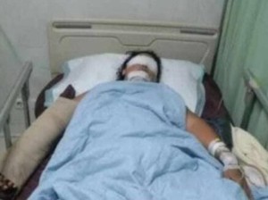 Terungkap! Ini Motif Supri Aniaya Istri Siri hingga Buta