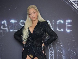 Gaya Terbaru Beyonce Setelah Dituduh Memutihkan Kulit, Pamer Kaki Jenjang