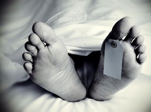 Ahli Anatomi Jelaskan Kondisi Pengawetan Cadaver, Semua yang Melekat Dilepaskan
