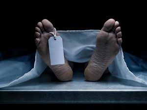 Geger Temuan Mayat di Medan Ternyata Cadaver, Apa Sih Itu? Ini Kata Dokter Anatomi