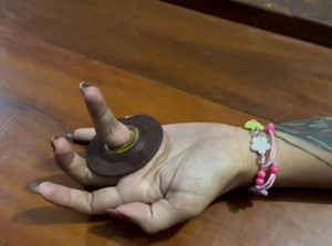 Ada-ada Saja, Jari Perempuan Trenggalek Ini Tersangkut Lubang Mata Gerinda