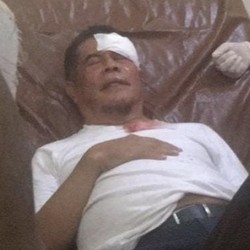 Pengantaran Jenazah Lukas Enembe Ricuh, Begini Kronologinya