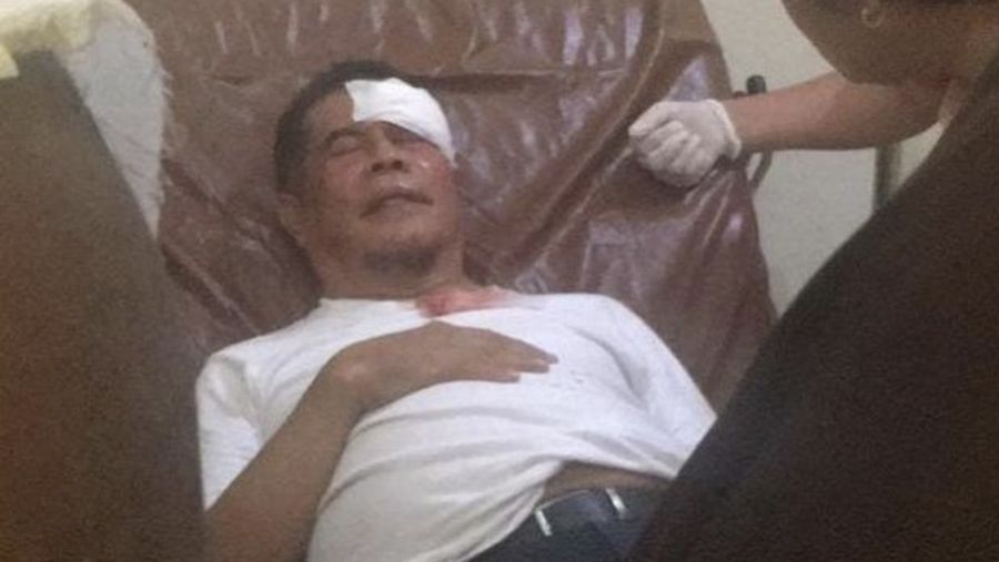 Kondisi PJ Gubernur Papua, Ridwan Rumasukun usai terkena lemparan batu oleh pengantar jenazah Lukas Enembe. (Dok. Istimewa)