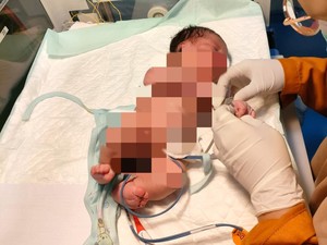 Nelangsa Bayi Baru Satu Jam Dilahirkan Dibuang di Persawahan Blitar