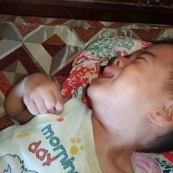 Kisah Pilu Bocah Yusril Berjuang Sembuh Tanpa Ayah Ibu