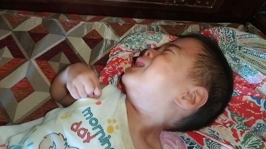 Yusril anak penderita komplikasi hernia dan paru-paru di Lampung Timur. (Dok. Berbuat Baik)