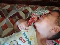 Kisah Pilu Bocah Yusril Berjuang Sembuh Tanpa Ayah Ibu