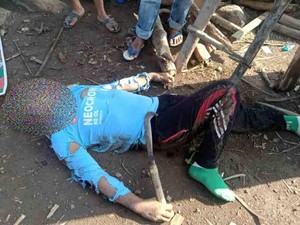 Petani Bima Ditemukan Tewas di Ladang Diduga Tersambar Petir