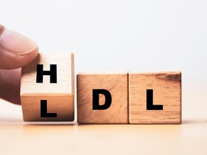 Tips Sehat Cegah Kolesterol Saat Santap Hidangan Idul Adha