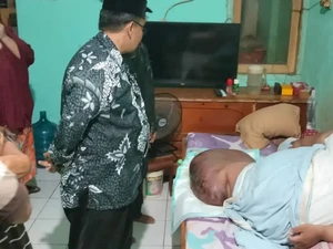 Kata Kemenkes soal Pria Tangerang Kena Limfedema-Obesitas, BB 230 Kg