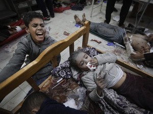 Kisah Pilu Dokter Rawat Anak-anak yang Matanya Hancur Imbas Ledakan di Gaza