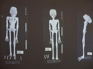 Kontroversi Mumi Alien di Peru, Sidik Jarinya Disebut Tak Cocok dengan Manusia