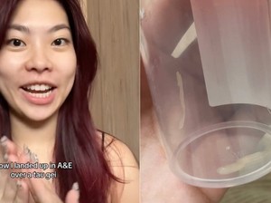 Ada Tauge Nyangkut di Tenggorokannya, Wanita Ini Habiskan 9 Jam di Rumah Sakit