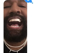 Kanye West Tampil dengan Gigi Titanium ala Musuh James Bond, Rogoh Rp 13 M