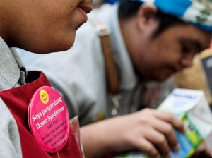 Benarkah Pengidap Down Syndrome Tak Bisa Punya Keturunan? Ini Kata Dokter