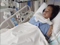 Akibat Ditabrak Tronton, Anak Piatu Pekerja Serabutan Berjuang Sembuh