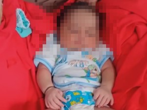 Sederet Fakta Bayi di Sampang Lahir dengan 24 Jari Bikin Penasaran