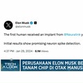 Video: Perusahaan Elon Musk Berhasil Tanam Chip di Otak Manusia