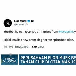 Video: Perusahaan Elon Musk Berhasil Tanam Chip di Otak Manusia