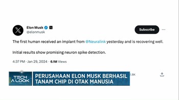Video: Perusahaan Elon Musk Berhasil Tanam Chip di Otak Manusia