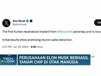 Video: Perusahaan Elon Musk Berhasil Tanam Chip di Otak Manusia