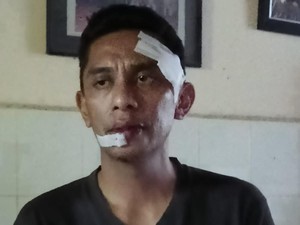 ASN di Kendari Diduga Dianiaya Sekretaris BPSDM Sultra, Polisi Selidiki