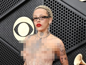 Doja Cat Pamer Implan Payudara Tidak Simetris, Korban Gagal Operasi Plastik?