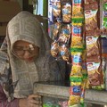 Foto: Ilustrasi wanita penderita lupus. (Dokumentasi Berbuat Baik)