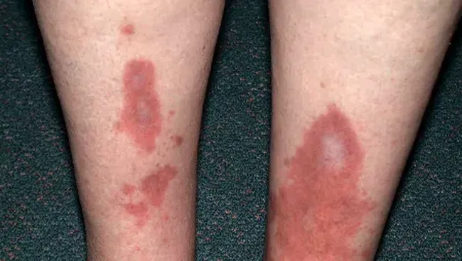 Kenalkan Tagatose, Pemanis Alami yang Nggak Bikin Insulin Nanjak