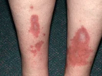 Kenalkan Tagatose, Pemanis Alami yang Nggak Bikin Insulin Nanjak