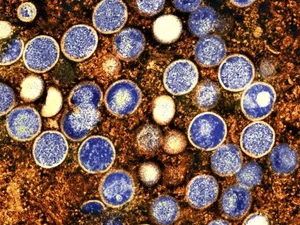 Ancaman Ngeri Virus Misterius Alaskapox, Pahami Gejala dan Pencegahannya