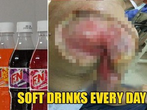 Kebiasaan Konsumsi Boba hingga Mie Pedas Membuat Orang Sakit Parah