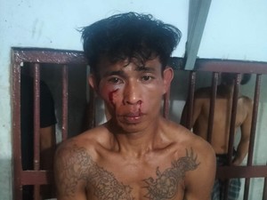 Tampang Pria Siram Air Keras ke Mantan Istri gegara Ditolak Rujuk