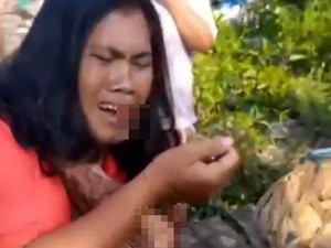 Ibu di Medan Ngaku Dianiaya Polisi saat Nyusui Anak, Ditampar-Mulut Berdarah