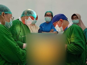 Kista Seberat 7,1 Kg Diangkat dari Tubuh Pasien RSUD Genteng Banyuwangi