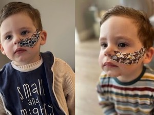 Kisah Anak Alami GTM Terparah, Tolak Makan Apapun Selama Lebih dari Setahun