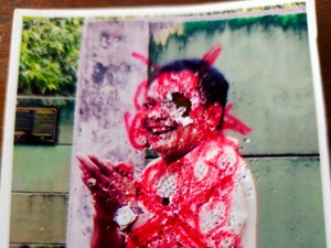 Terungkap Awal Mula Foto Ditusuk Jarum di Rumah Dukun Santet Ciputat