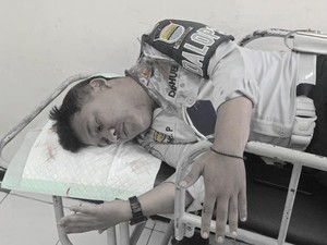 Tegur Warga, Petugas Dishub Bandung Dilempar Mangkuk Sampai Kepala Bocor