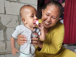 Pilunya Rey, Anak Tukang Somay yang Derita Stunting dan Kelainan Tubuh