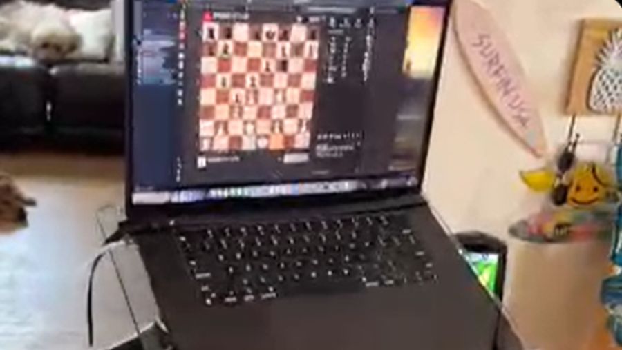 x/Neuralink