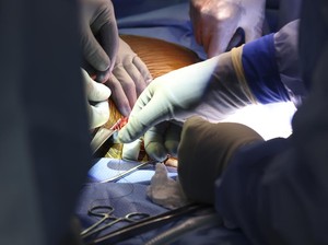 Pria Penerima Transplantasi Ginjal Babi Meninggal Dunia