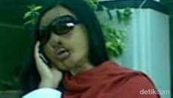 Kisah Kelam Lisa Face Off Pasien Pertama Transplantasi Wajah di Indonesia