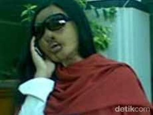 Kisah Kelam Lisa Face Off Pasien Pertama Transplantasi Wajah di Indonesia