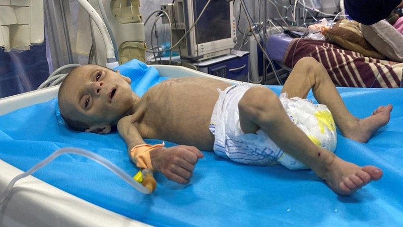 Balita Palestina Leila Jeneid, yang menderita kekurangan gizi parah, menerima perawatan di Rumah Sakit Kamal Adwan, di tengah konflik yang sedang berlangsung antara Israel dan Hamas di Gaza di mana kekurangan makanan dan nutrisi penting telah menjadi perjuangan kolektif di daerah kantong tersebut, di Jalur Gaza utara, 26 Maret 2024.REUTERS/Osama Abu Rabee