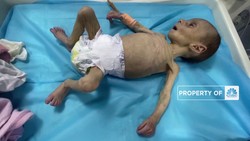 VIDEO : Bayi Palestina Melawan Kelaparan