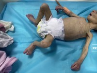 VIDEO : Bayi Palestina Melawan Kelaparan