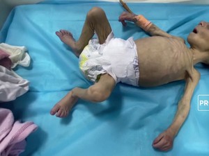 VIDEO : Bayi Palestina Melawan Kelaparan